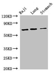 Polyclonal Rabbit anti-Human FOXN1 Antibody (IHC, WB)