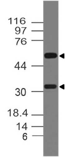 TNFSF11 / RANKL / TRANCE Antibody