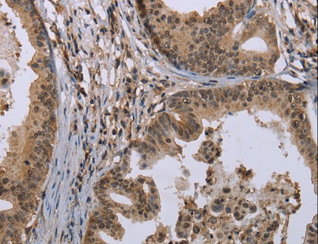 Polyclonal Rabbit anti-Human MCC Antibody (IHC)
