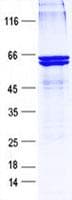 Human ZNF324 / ZF5128 Protein (Recombinant His, N-Terminal)