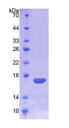 Mouse TREM1 Protein (Recombinant 6His, N-terminus)