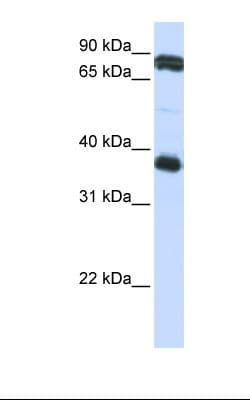 Polyclonal Rabbit anti-Human GP6 / GPVI Antibody (aa216-265, IHC, WB)