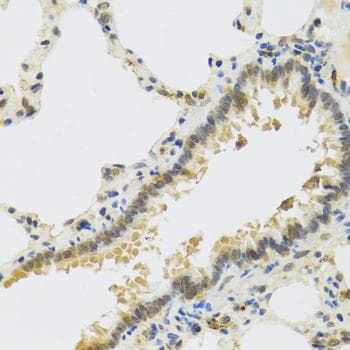 RSPO1 / RSPO Antibody