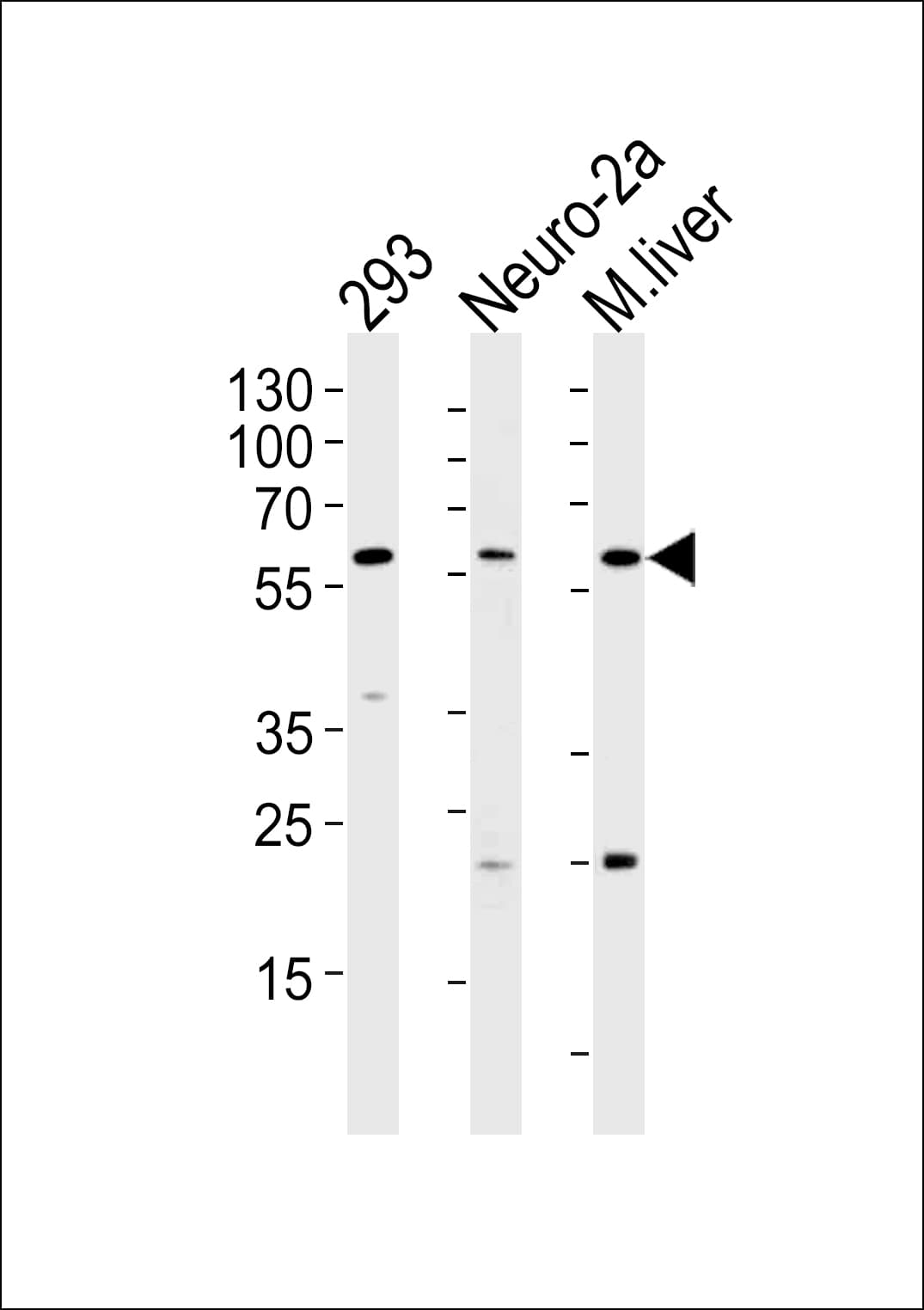 CCDC36 Antibody (aa422-450)