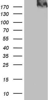 TG / Thyroglobulin Antibody (aa20-358, clone OTI11F8)
