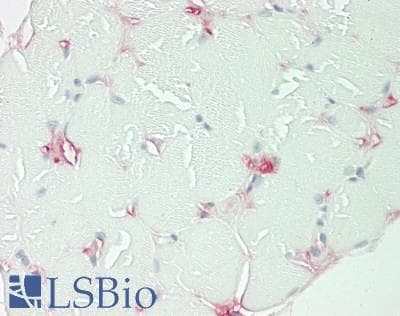 IHC-plus™ MASP2 / MASP-2 Antibody (Internal)