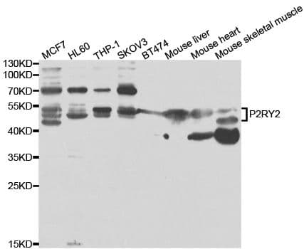 P2RY2 / P2Y2 Antibody