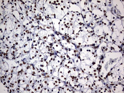 DDX56 Antibody (aa323-547, clone OTI11H7, Carrier-free)