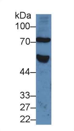 FZD1 / Frizzled 1 Antibody (aa117-322)