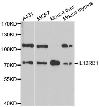IL12RB1 / CD212 Antibody