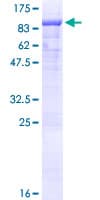 Human EYA4 Protein (Recombinant GST)