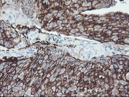 FXYD3 Antibody (clone OTI1F12)