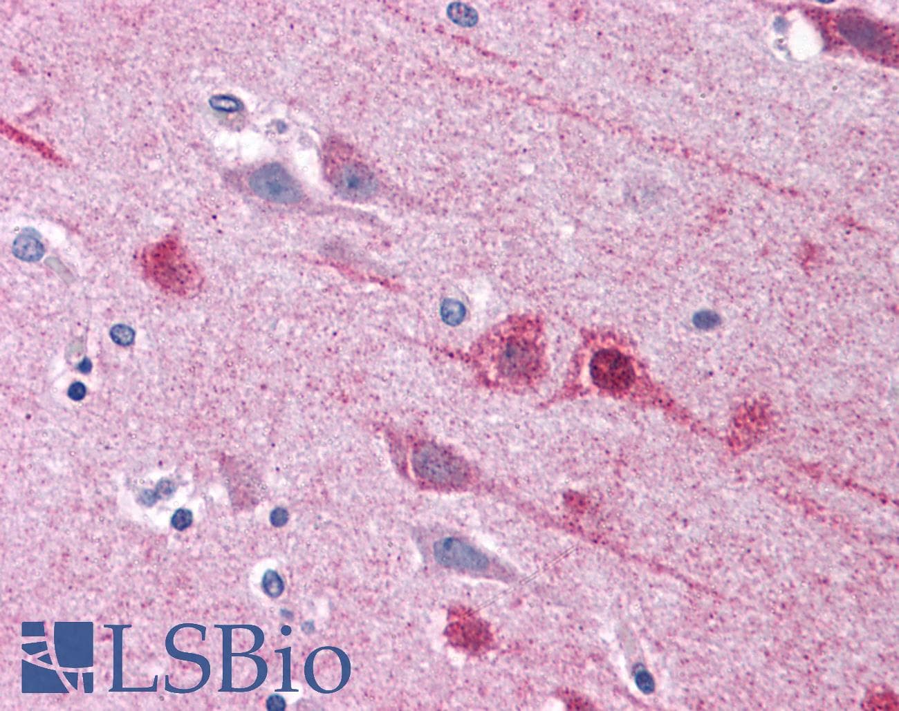 IHC-plus™ EMX2 Antibody