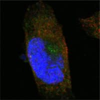 IHC-plus™ Monoclonal Mouse anti-Human SORL1 Antibody (clone 3B6B11, aa2158-2214, IHC, IF, WB)