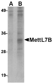 IHC-plus™ METTL7B Antibody