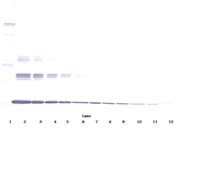 TNF Alpha Antibody