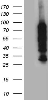 PPM1D / WIP1 Antibody (aa1-375, clone OTI4H3)