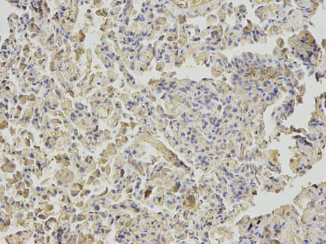 Polyclonal Rabbit anti-Human NUDT1 / MTH1 Antibody (IHC, WB)