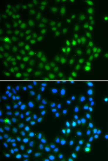SALL4 Antibody