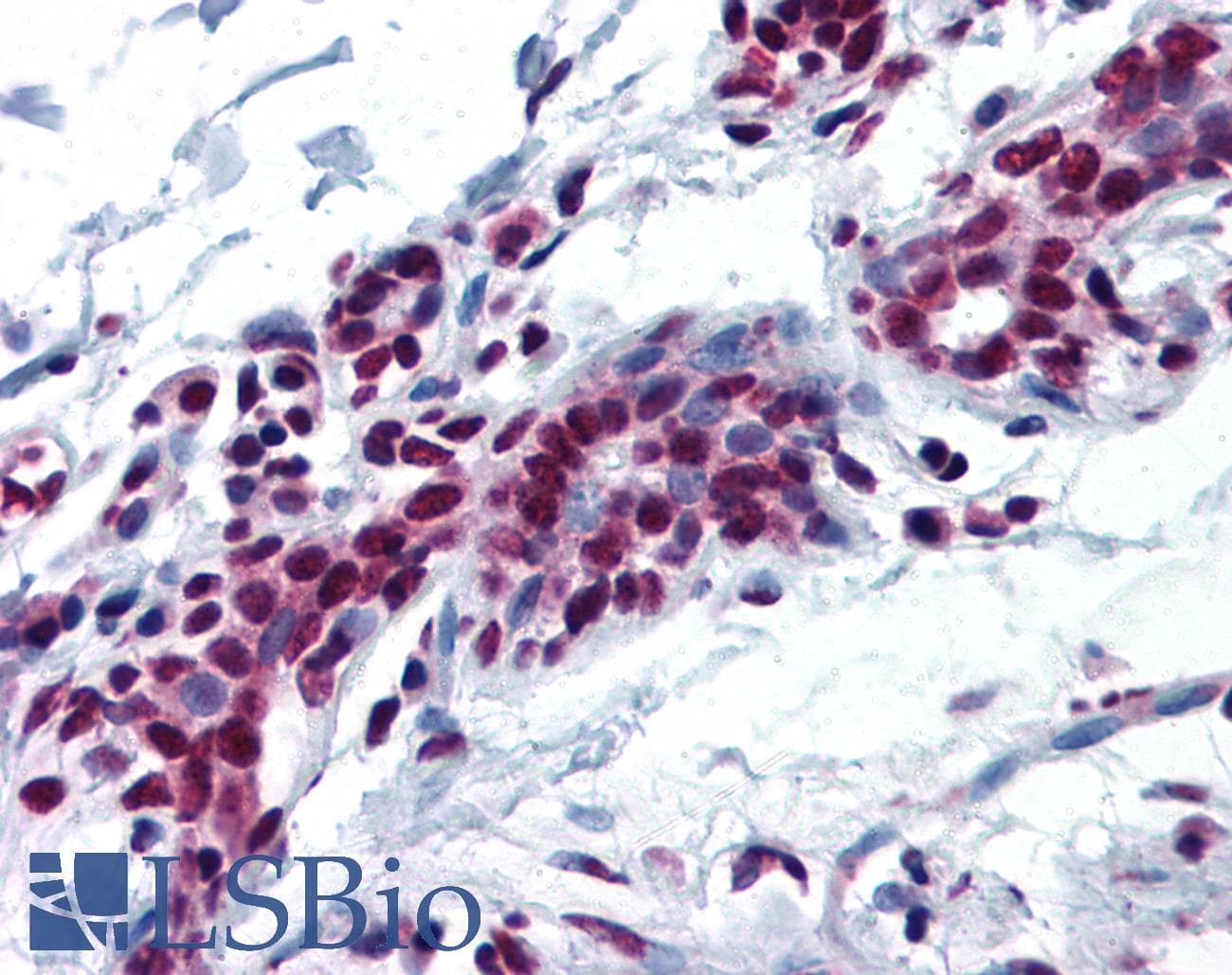 IHC-plus™ MYB / c-Myb Antibody (aa1-50)
