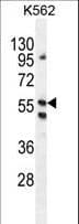 LRRC21 Antibody (aa594-622)
