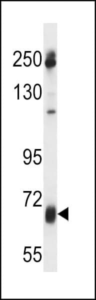Polyclonal Rabbit anti-Human GGT7 Antibody (aa24-53, IHC, WB)