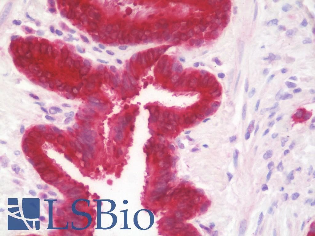 IHC-plus™ Polyclonal Rabbit anti-Human GGCT Antibody (aa139-168, IHC, WB)