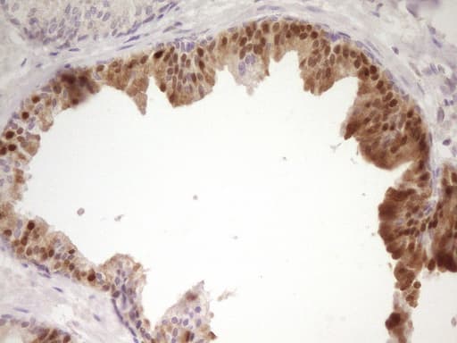 Monoclonal Mouse anti-Human PAPSS2 Antibody (clone OTI2E7, aa1-247, IHC, WB)