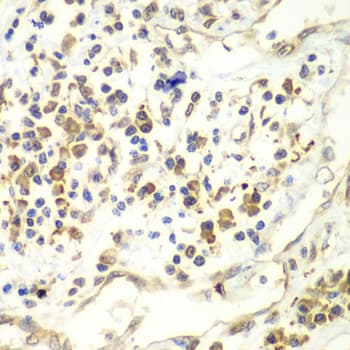 RENT1 / UPF1 Antibody