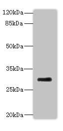 Polyclonal Rabbit anti-Human NANOS3 / NOS-3 Antibody (WB)