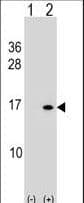 HIST1H2BB Antibody (aa1-30)