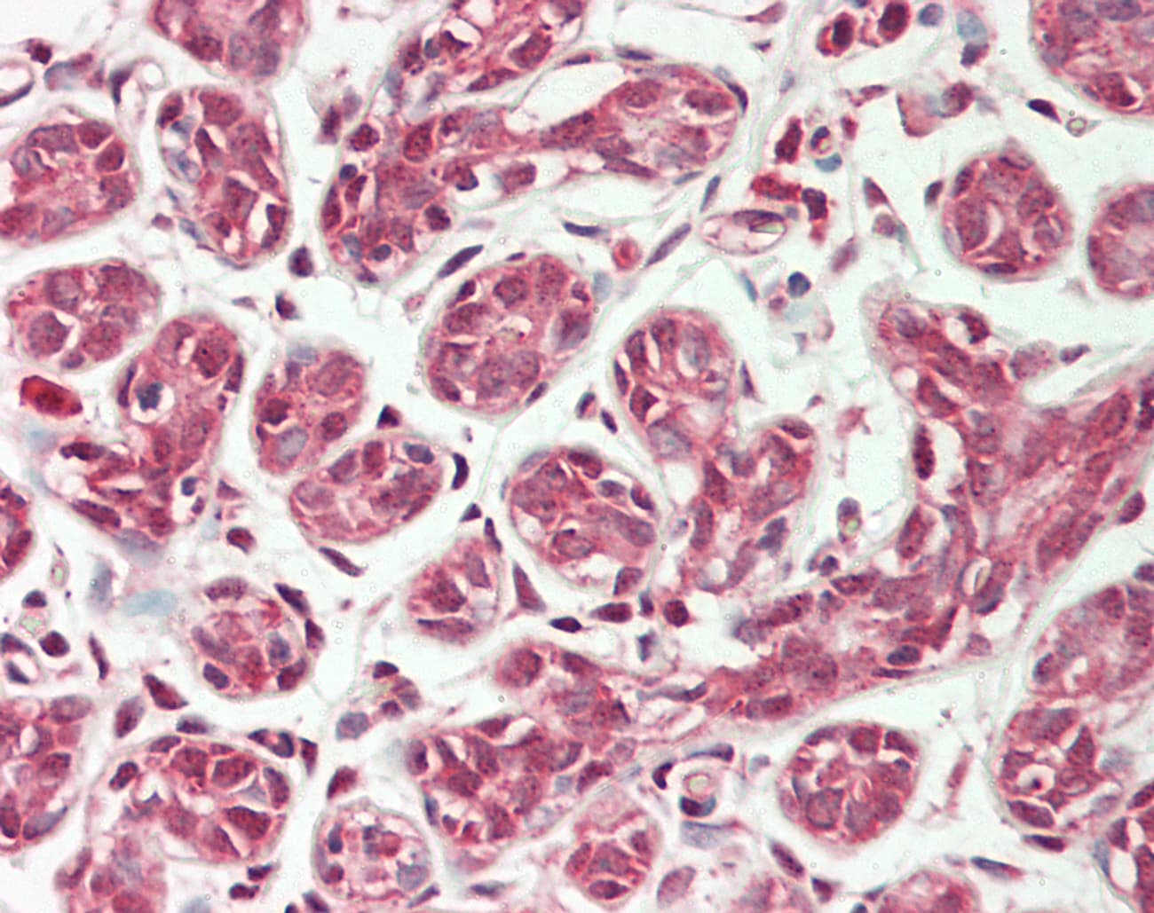IHC-plus™ PEX11B Antibody (aa132-177)
