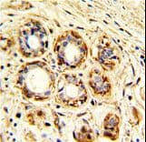 Polyclonal Rabbit anti-Human CTSK / Cathepsin K Antibody (aa207-237, IHC, WB)