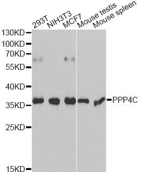 Polyclonal Rabbit anti-Human PPP4C Antibody (IF, WB)