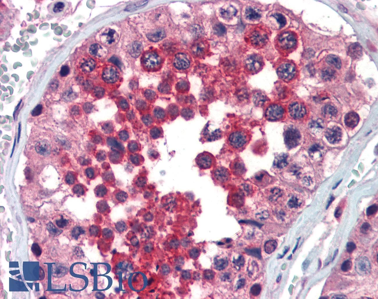 Polyclonal Rabbit anti-Human SLIM / FHL1 Antibody (aa51-100, IHC, WB)