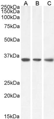 IHC-plus™ Polyclonal Goat anti-Human MDH / MDH2 Antibody (Internal Region, IHC, WB)