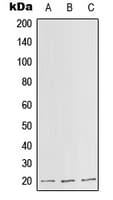 IHC-plus™ Polyclonal Rabbit anti-Human SLC25A11 Antibody (Internal, IHC, WB)