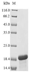 Human HEATR6 / ABC1 Protein (Recombinant 10His, N-terminus + Myc, C-terminus)