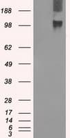 BUB1B / BubR1 Antibody (clone OTI5D9)
