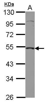Polyclonal Rabbit anti-Human CASP2 / Caspase 2 Antibody (WB)