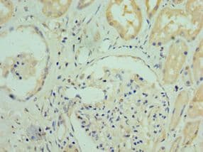 RGS20 / RGSZ1 Antibody (aa1-241)