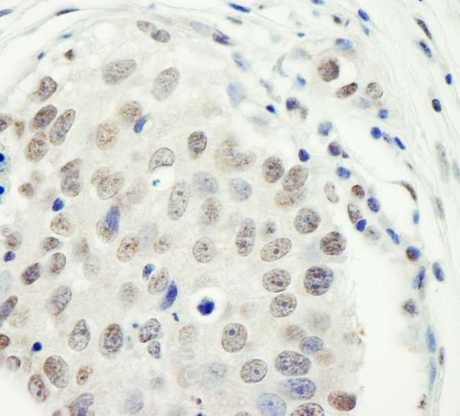 ZC3H11A Antibody (aa700-750)