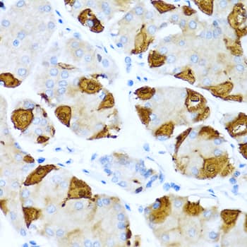 S100A7 / Psoriasin Antibody