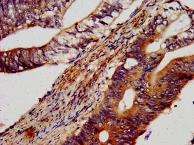 LIN41 / TRIM71 Antibody