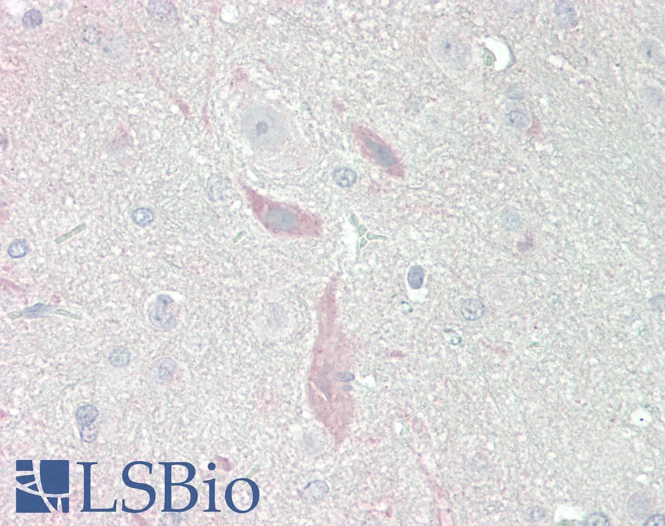 IHC-plus™ GRIN2A / NMDAR2A / NR2A Antibody (N-Terminus)
