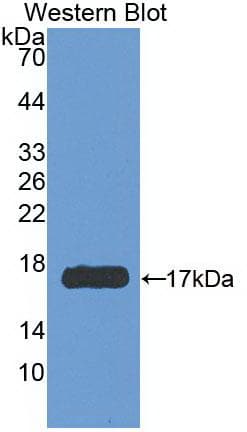 IFN Gamma / Interferon Gamma Antibody