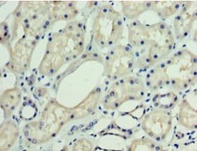 Polyclonal Rabbit anti-Human DNAJC30 Antibody (IHC)