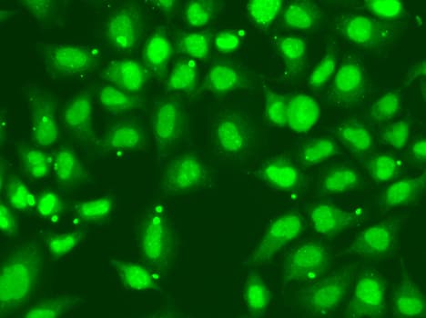 FANCD2 Antibody