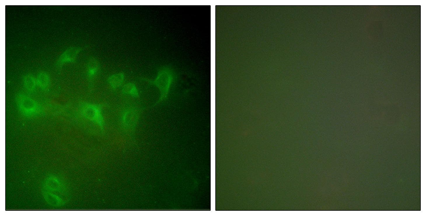 MDM2 Antibody