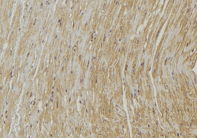 PLOD2 Antibody
